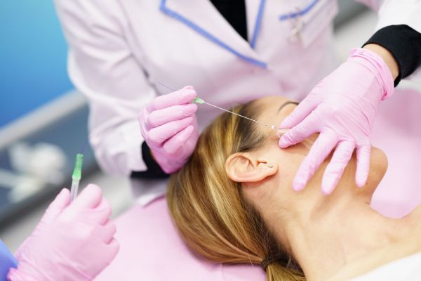 PDO Threads Lift Treatment at Serenity MedSpa in Bloomington, IL