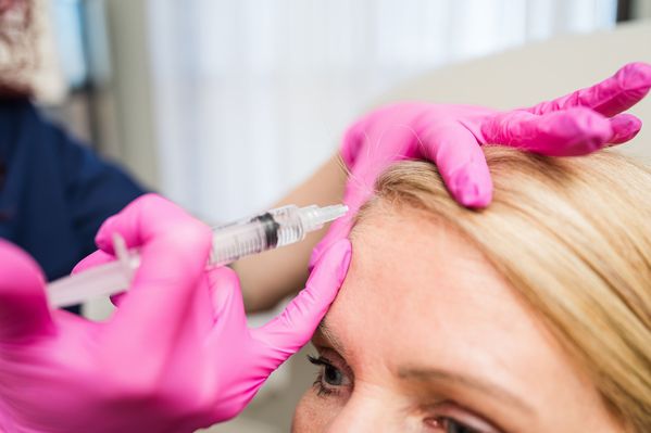 platelet rich plasma hair restoration by licensed professionals in Bloomington, IL