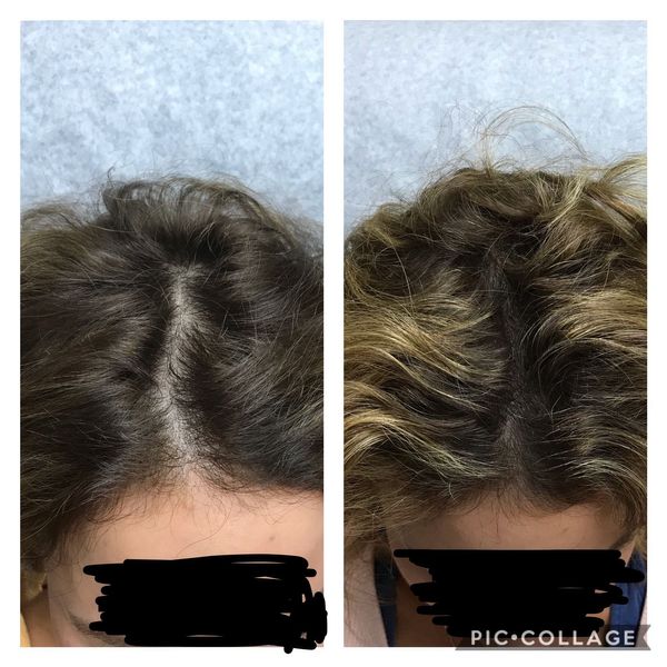 Jamie-2-treatments